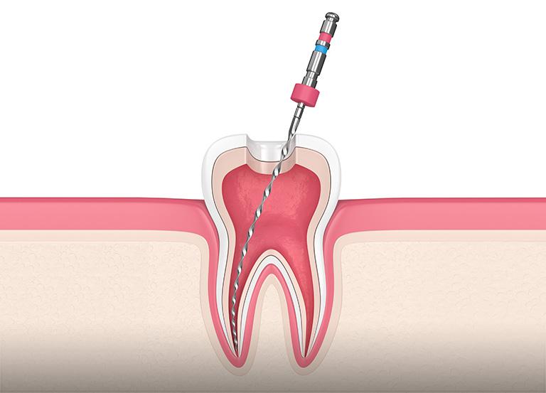 endodoncja